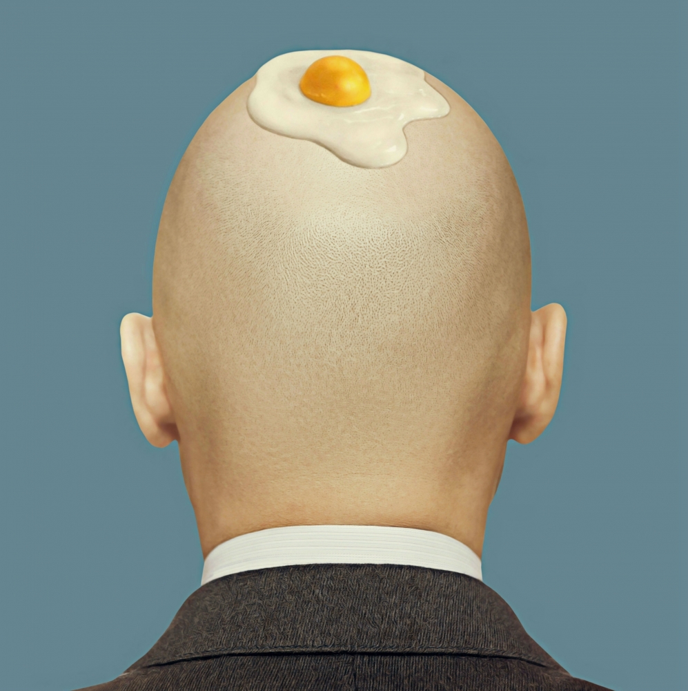 Baldy