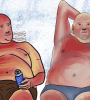 Sunbathers