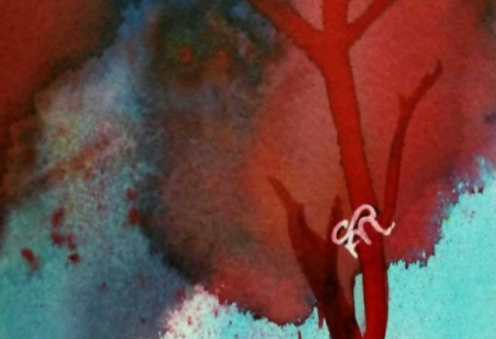 Red and Blue Trees 