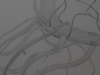 Root.