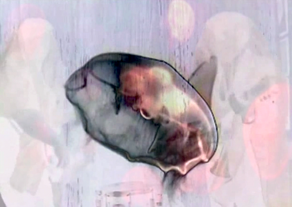 Save The Jellyfish 7