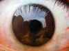 Lu Zhengyuan, pintura hiperrealista, ojo, 2008